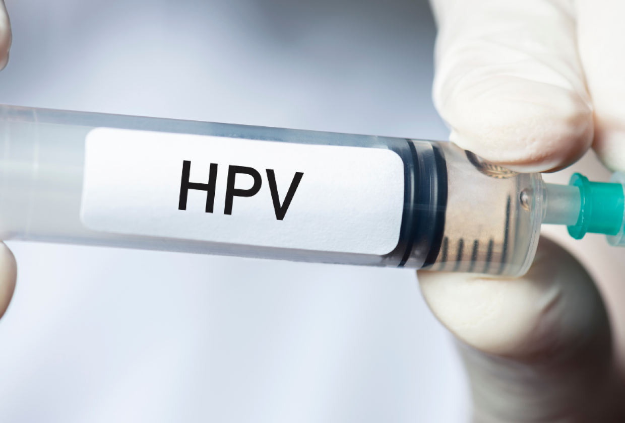 HPV test